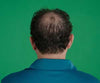 Hair Grow Max 2x1 a 214 PLN